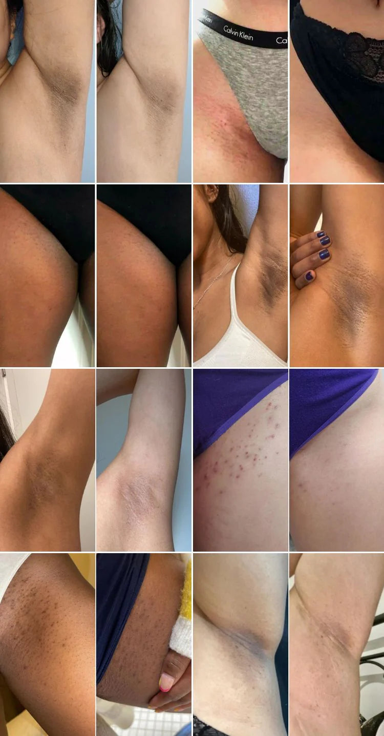 Bikini Trimmer™ - Få len hud med stil
